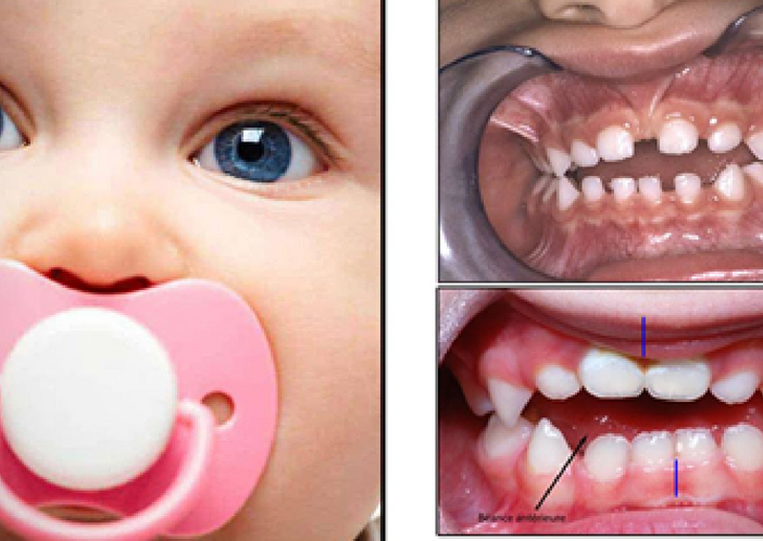teeth problem