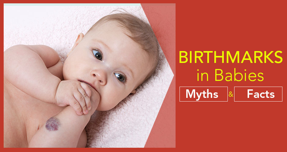 Does your baby has BIRTHMARKS? Here are some Myths and Facts