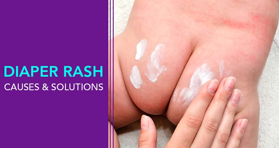 Diaper Rash: Causes and Solutions