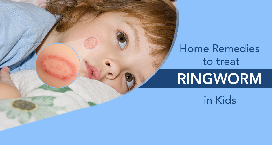 7 Home Remedies to treat Ringworm