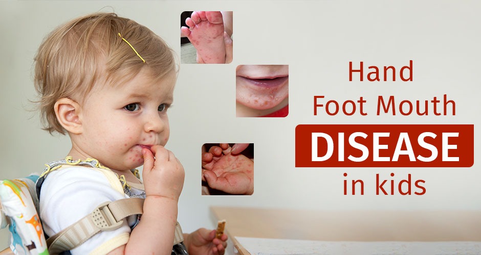 Protect your Child from Hand Foot Mouth Disease