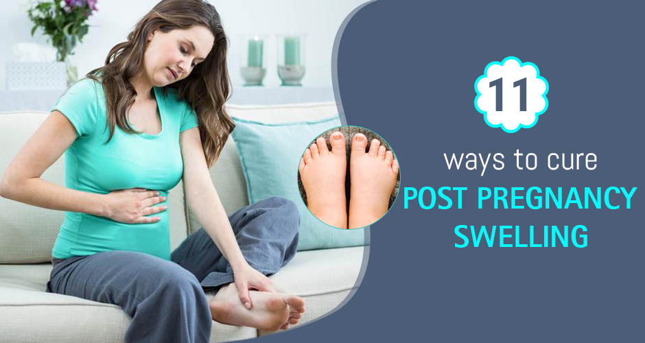 11 Best Ways To Get Rid Of Post Pregnancy Swelling