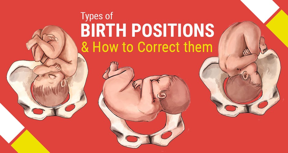 different-types-of-birth-positions-how-to-correct-them-for-delivery