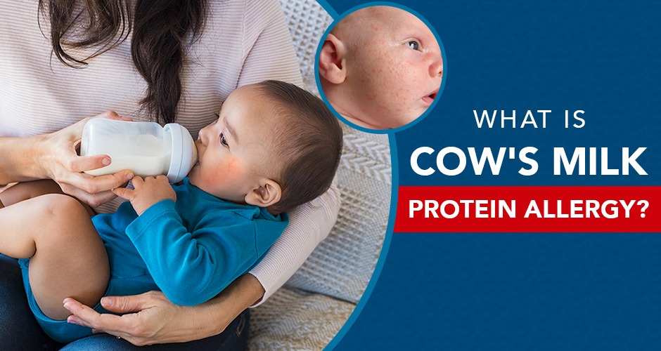 What Is Cow’s Milk Protein Allergy?
